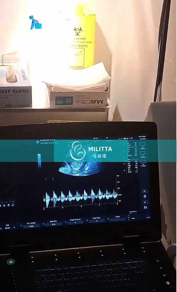 试管妈妈做孕16周B超