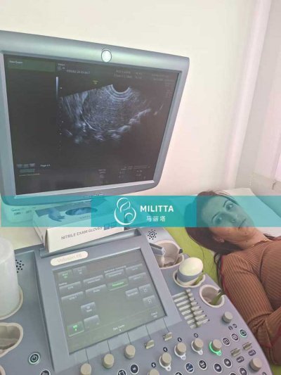 6位新试管妈妈在格鲁吉亚医院安心调理内膜