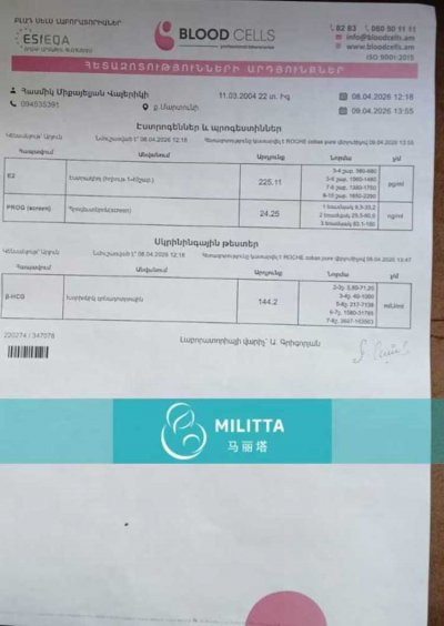 董夫妇在格鲁吉亚Beta医院做自卵试管验孕成功