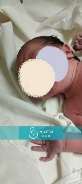 李夫妇在格鲁吉亚顺利迎来新生儿,产院拍出生