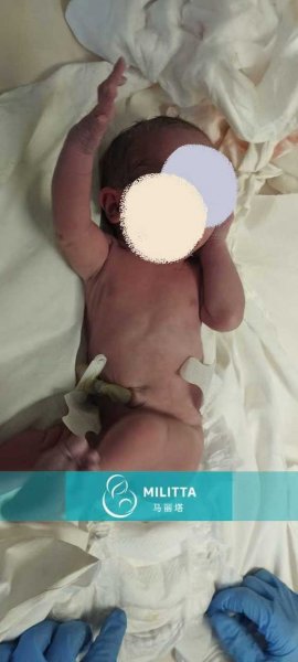 格鲁吉亚试管喜讯:陈先生家庭顺利迎来健康男