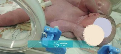 格鲁吉亚试管成功案例分享:梁夫妇喜迎双胞胎